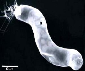 La fotografía micoscópica al meteorito CI1 muestra una estructura 
similar al de la bacteria gigante Titanospirillum velox, un organismo 
que está en la Tierra.