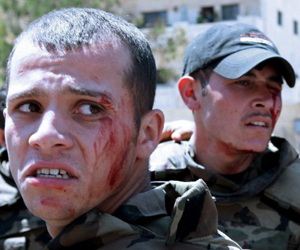 Dos de los soldados heridos por la explosión. Foto: Louai Beshara/AFP.