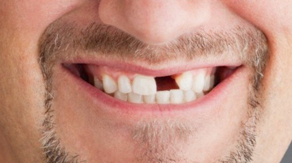 Los dientes podrán volver a crecer gracias a células madre