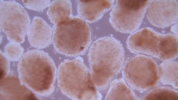 células madres