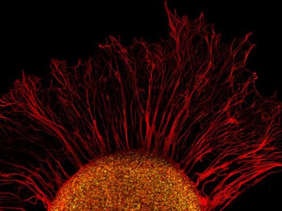 Ganglios de la raíz dorsal de una neurona de pollo