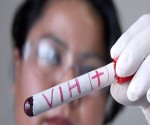 Científicos estadounidenses desarrollan en monos estrategia efectiva contra VIH