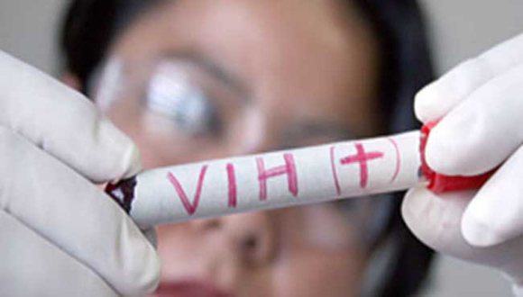 Dos infectados de VIH se curan espontáneamente